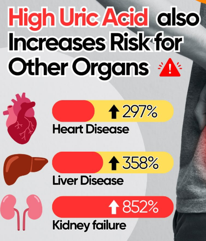 High uric acid increases risk for heart, liver, and kidney issues infographic